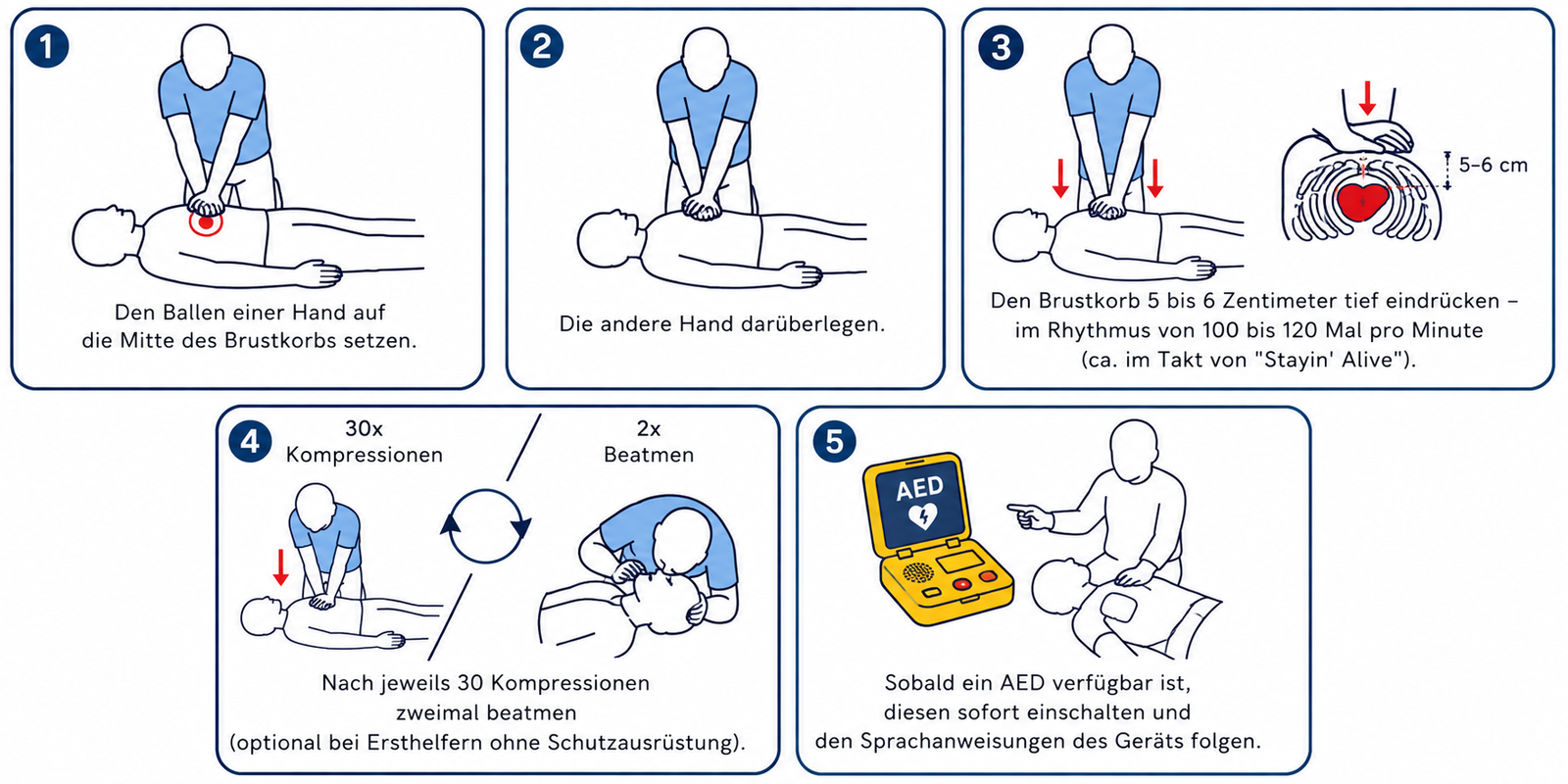 Fünf Schritte zur Herz-Lungen-Wiederbelebung und AED